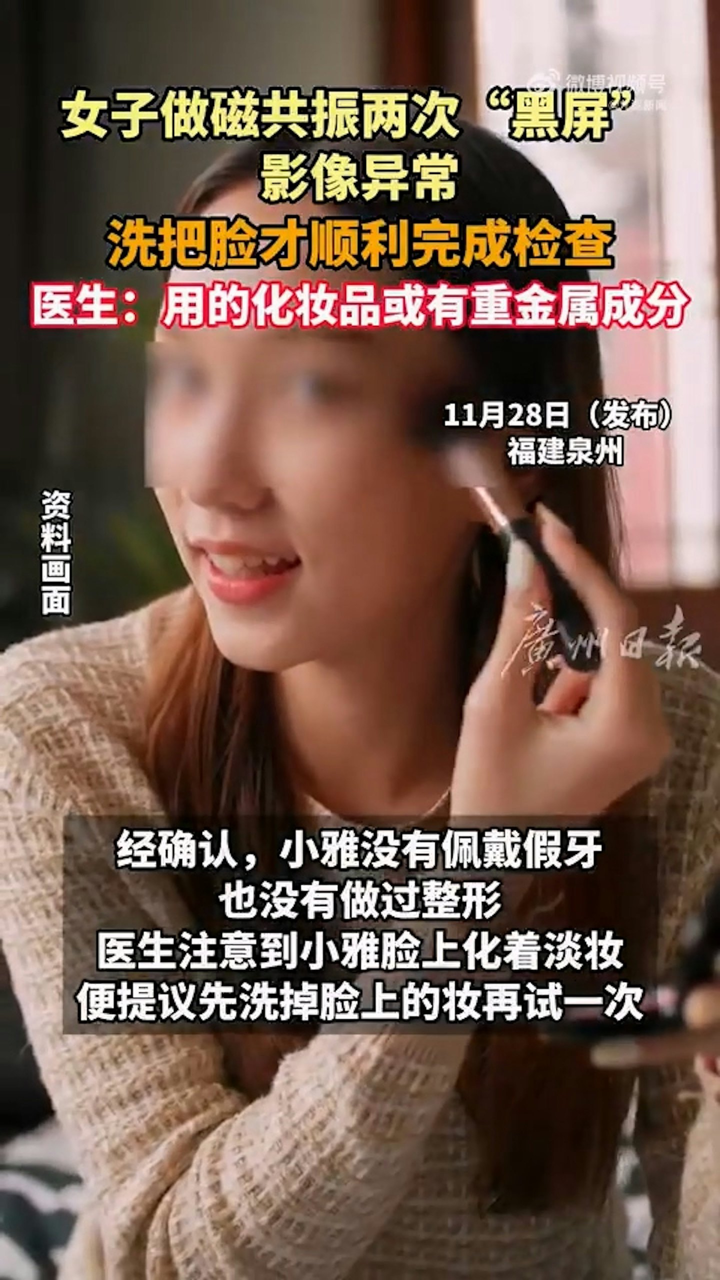 女生做磁力共振两次失败洗脸后才完成，元凶竟是祂（组图） - 3