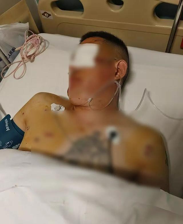 男子银行取170万遭抢劫：歹徒也没给我机会，照头就一枪（组图） - 1