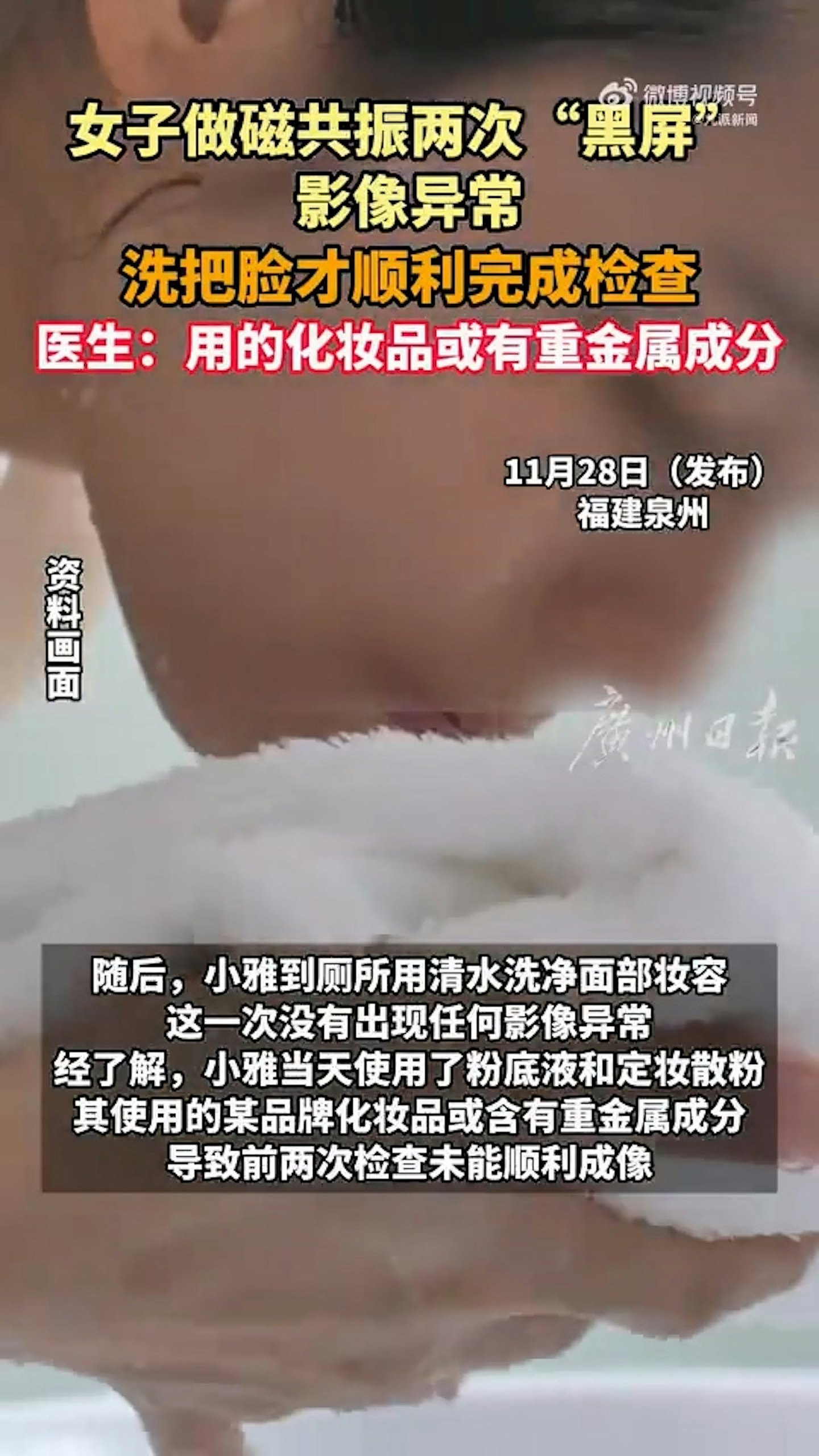 女生做磁力共振两次失败洗脸后才完成，元凶竟是祂（组图） - 4
