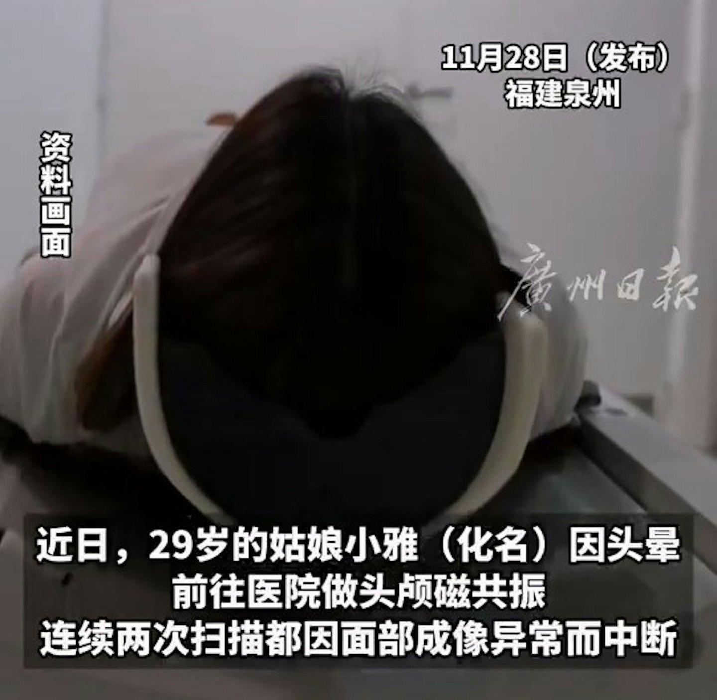 女生做磁力共振两次失败洗脸后才完成，元凶竟是祂（组图） - 2