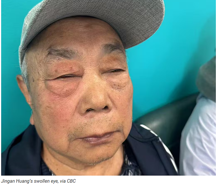 太离谱！华人一家在机场遭粗暴对待：撕票、抢手机，老人当场受伤（组图） - 7