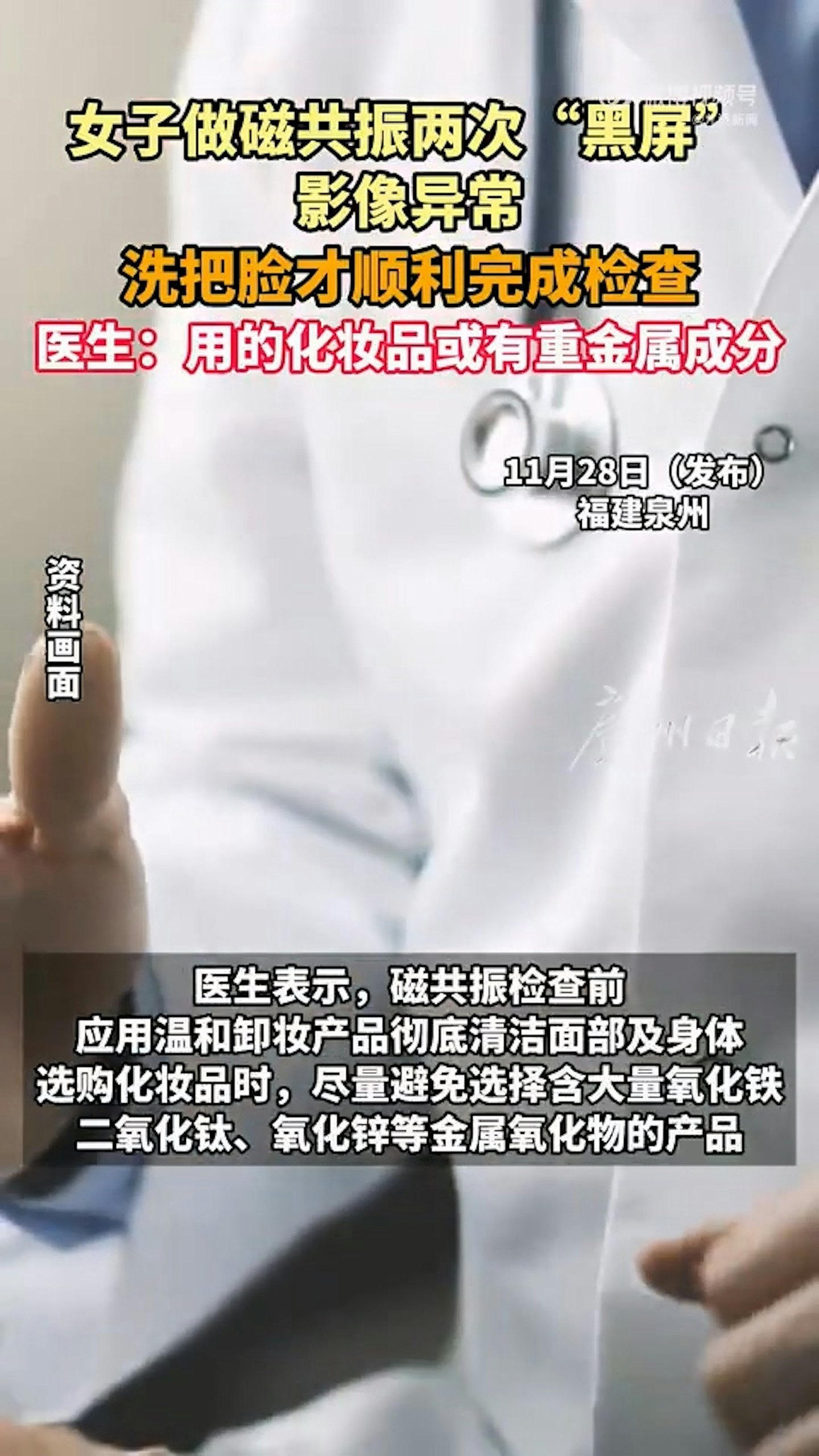 女生做磁力共振两次失败洗脸后才完成，元凶竟是祂（组图） - 5
