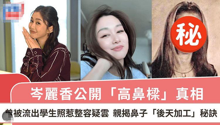 恭喜正式复出！越整越丑大变样，突然退圈结婚生子（组图） - 24
