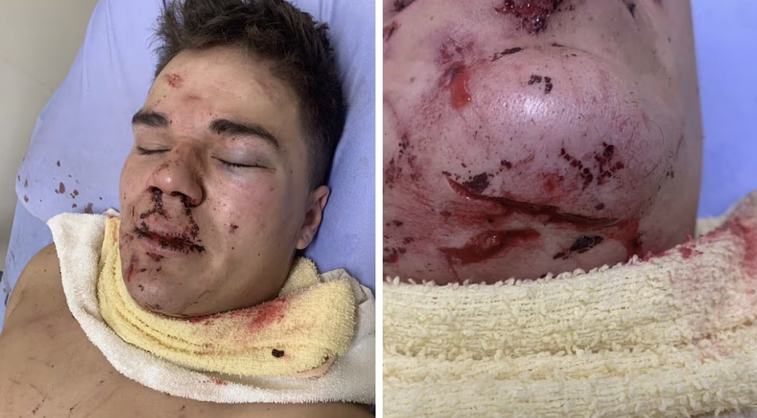 炸锅！ 加拿大男子杀人不用坐牢？！狂捅19刀血溅现场、判决引爆全网！家属崩溃怒吼...（组图） - 2