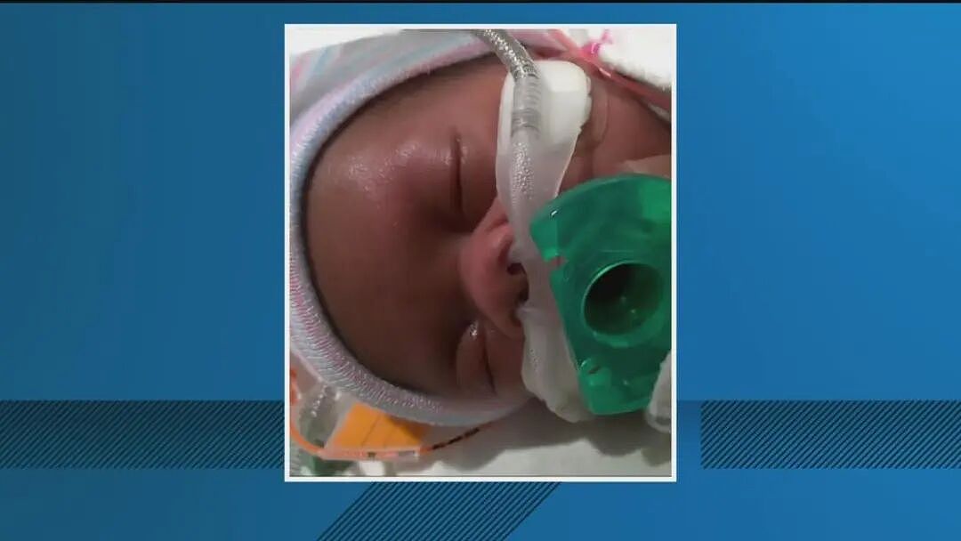 美国脑死亡孕妇被强行续命?等生下孩子才可以安息?(组图) - 4