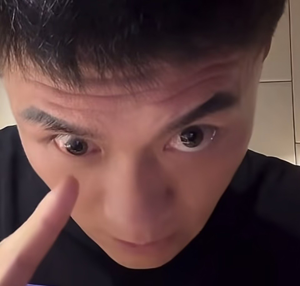 中国武术大师扇耳光落下终身残疾？一只眼歪了，两只眼睛无法同步移动（组图） - 3