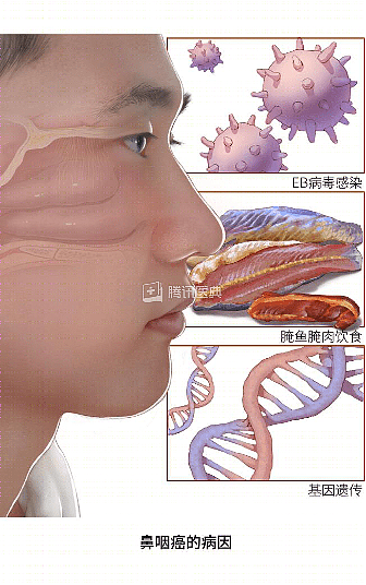 别把癌症当鼻炎!爱吃这类食物的人,尤其要警惕(组图) - 6