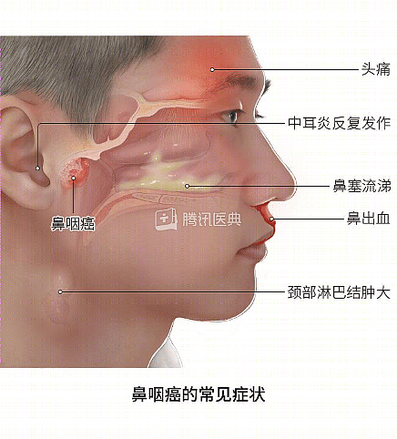 别把癌症当鼻炎!爱吃这类食物的人,尤其要警惕(组图) - 8
