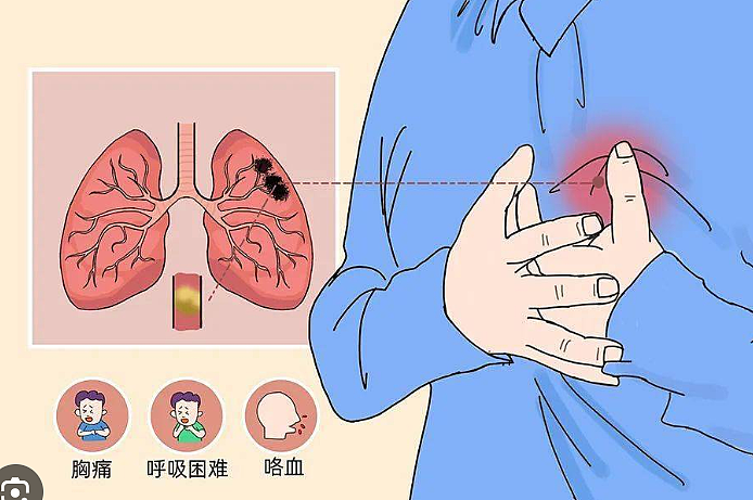 悲剧！新西兰华女乘机回中国，落地离奇猝死！每个人都可能“中招”…（组图） - 6