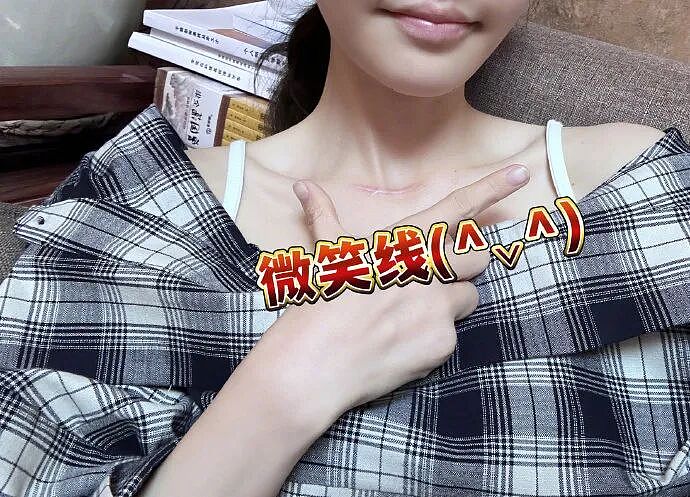 4000万粉丝网红冯提莫停播近一年后复播,称癌症复发后转移,目前已恢复!高危病,非“幸福癌”(视频/组图) - 3