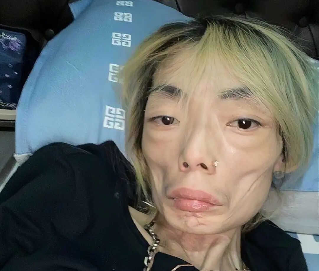豪门最惨阔太!22岁放弃牛津嫁豪门,结婚8年牙齿掉光,形似骷髅!被扫地出门的她,如今怎样了?(组图) - 1