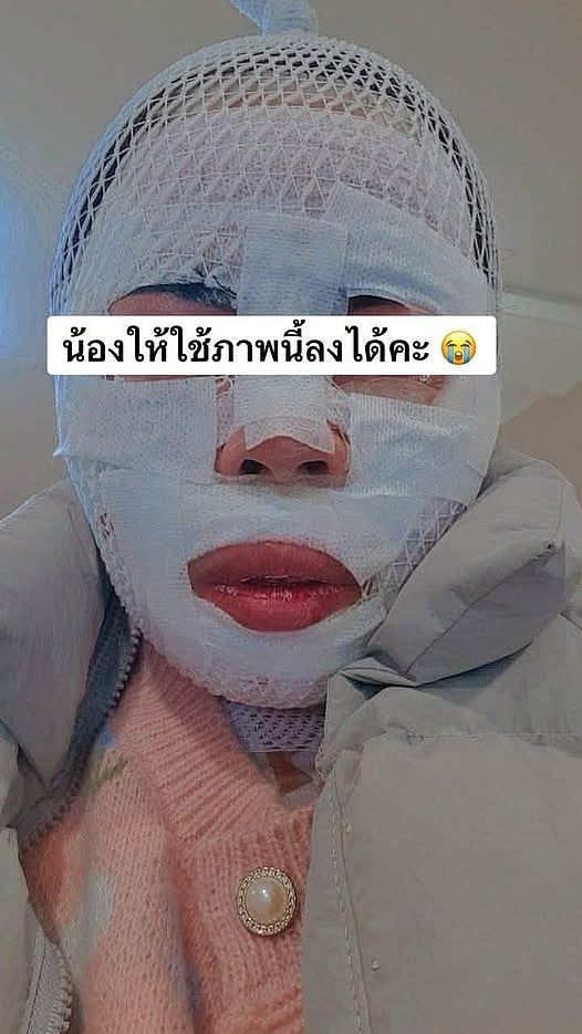 韩男担心泰籍妻子出轨,趁其熟睡用滚水淋脸:变丑就离不开我(组图) - 1