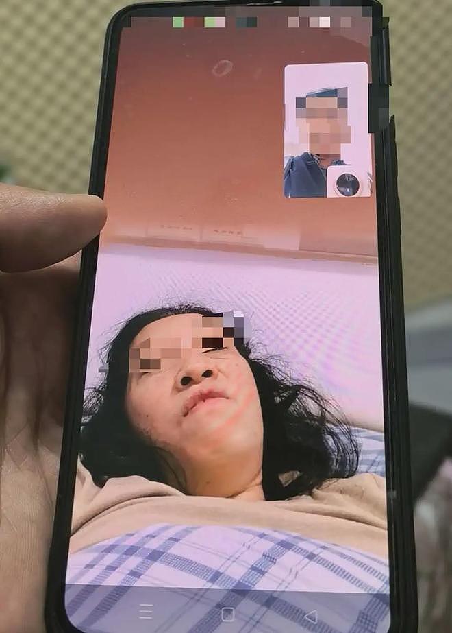 女子小区散步遭大狗咬断手筋，小伙冲下2楼摁住肇事狗，手掌被咬穿（组图） - 4