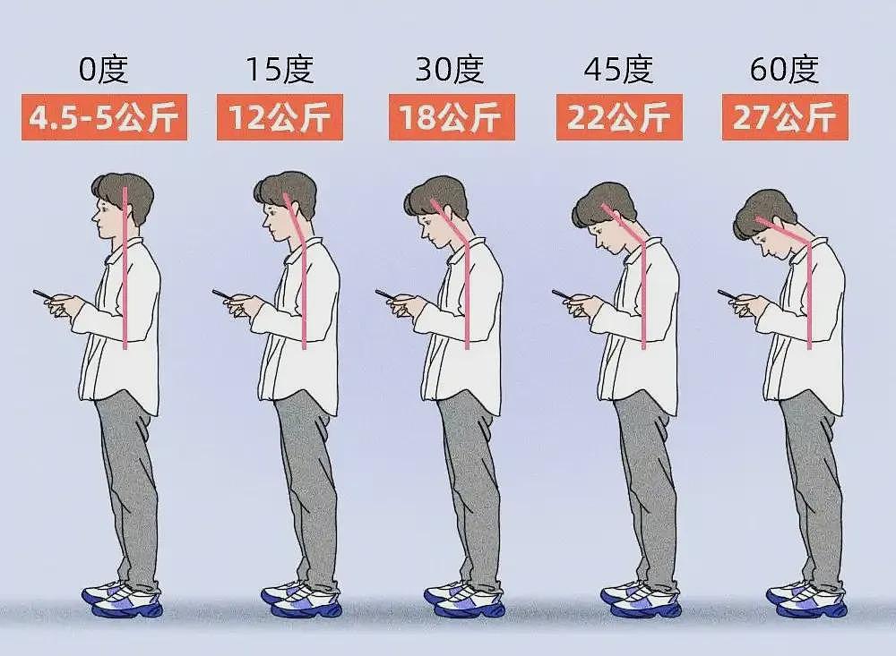 女子夜里翻身拿手机突然瘫痪！19 岁小伙长时间低头高位瘫痪！这些症状，切勿掉以轻心（组图） - 4