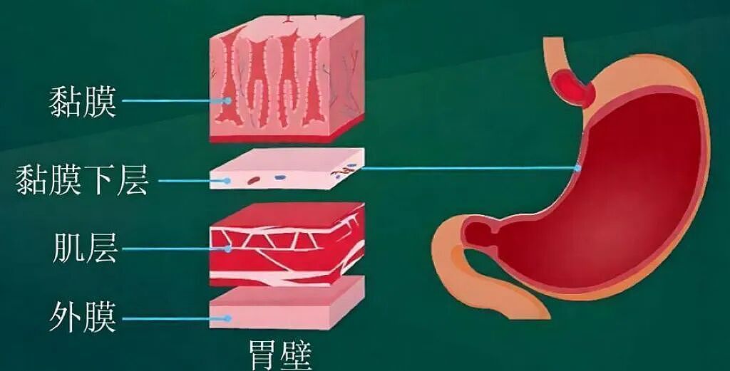 年龄越大胃越薄,趁早养成5个养胃习惯(组图) - 2