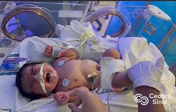 肚子囊肿突然变大，竟是因为后面藏了个娃？女子宫外孕怀到足月，母子平安，简直奇迹！（组图） - 6