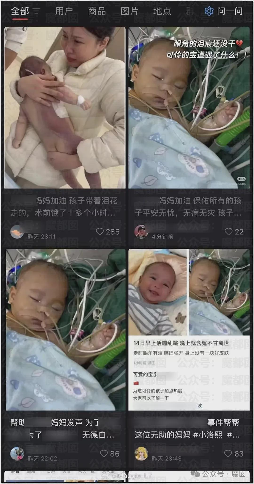 5个月婴儿做争议开胸术后去世，已有多个孩子殒命！全网为小洛熙讨说法（组图） - 26