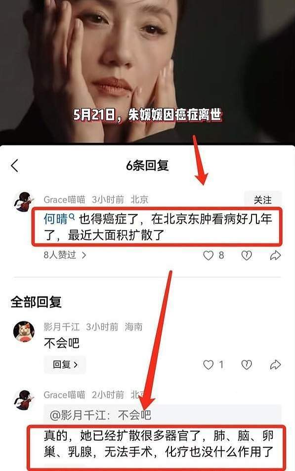 何晴患癌住院照曝光！面容憔悴浮肿严重，好友透露其生前最大遗憾（组图） - 3