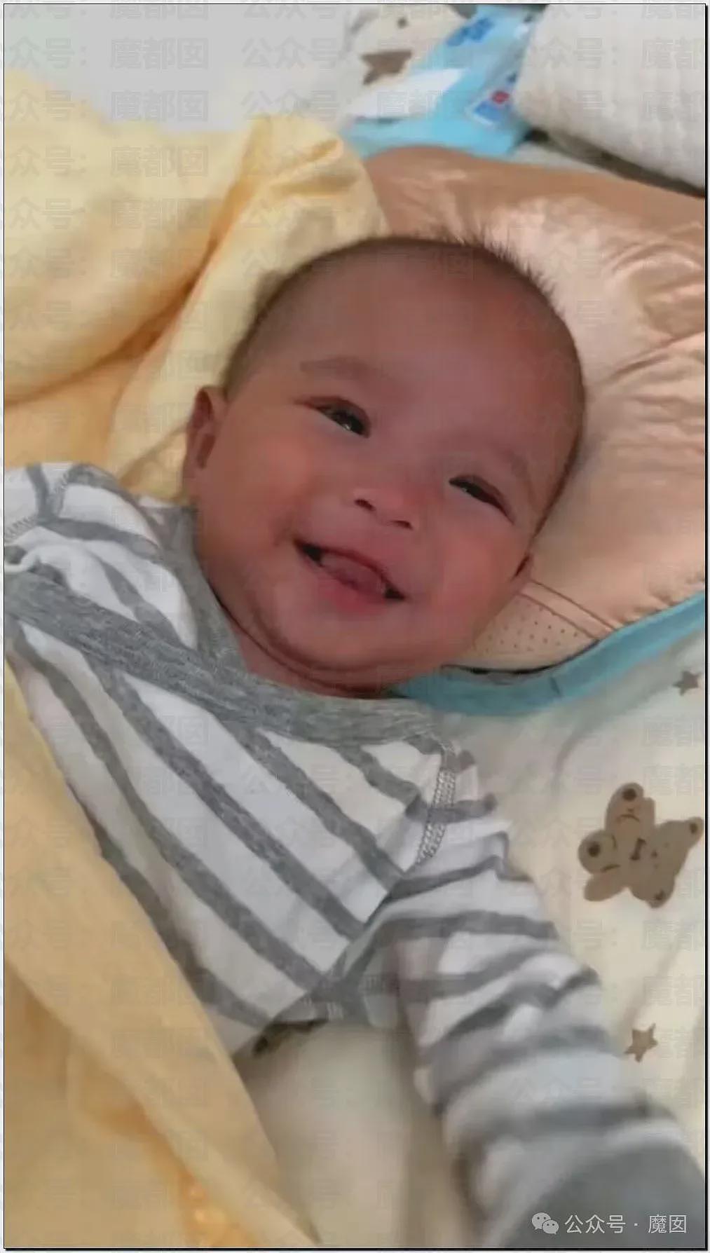 5个月婴儿做争议开胸术后去世，已有多个孩子殒命！全网为小洛熙讨说法（组图） - 8