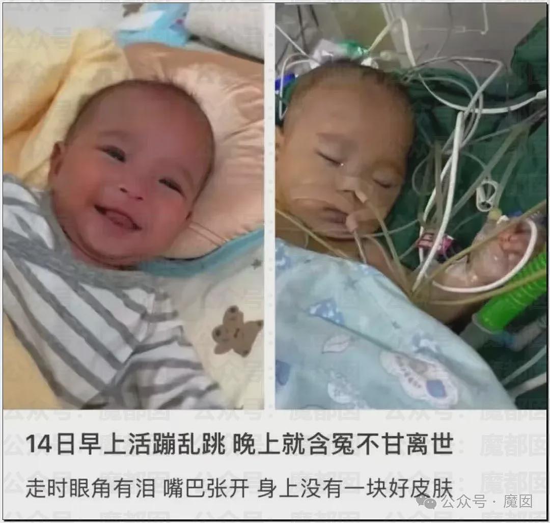 5个月婴儿做争议开胸术后去世，已有多个孩子殒命！全网为小洛熙讨说法（组图） - 4