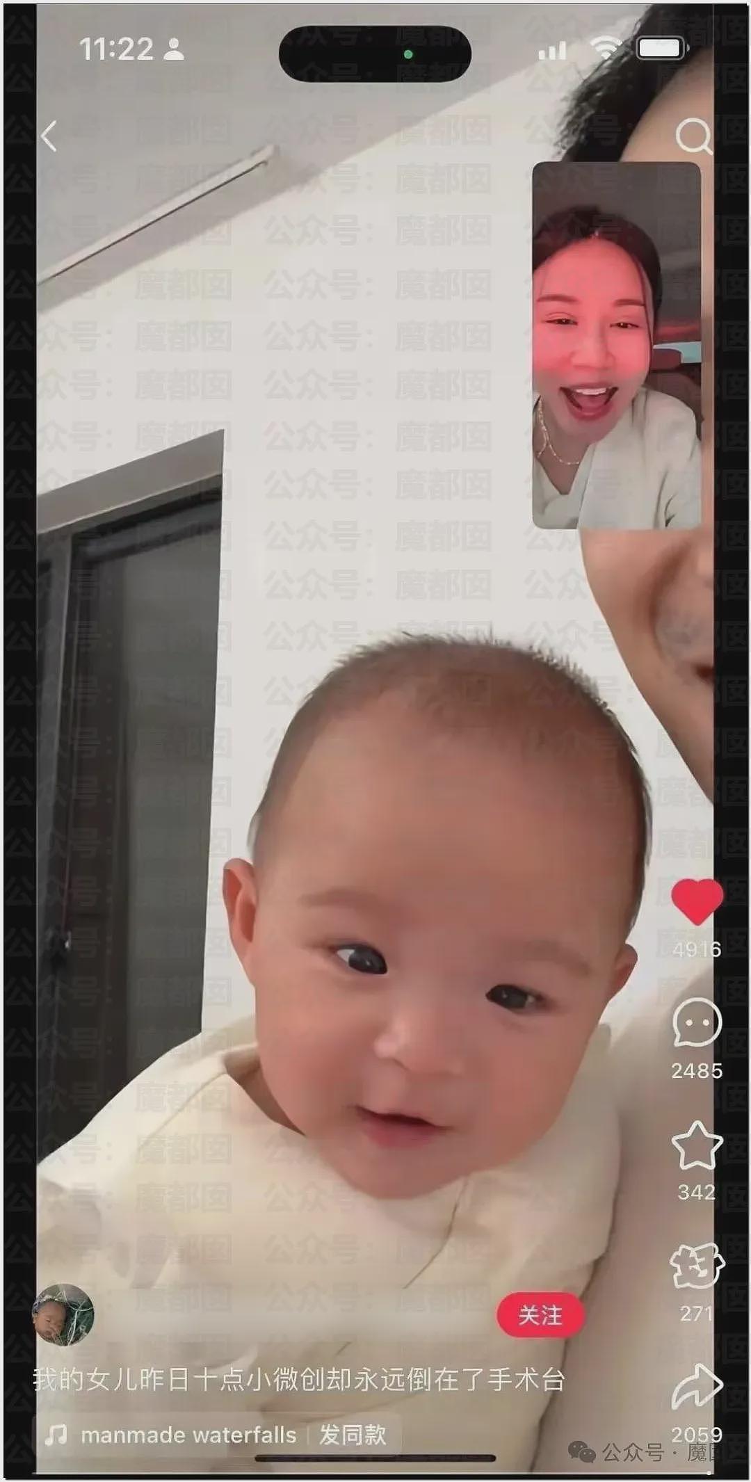 5个月婴儿做争议开胸术后去世，已有多个孩子殒命！全网为小洛熙讨说法（组图） - 12