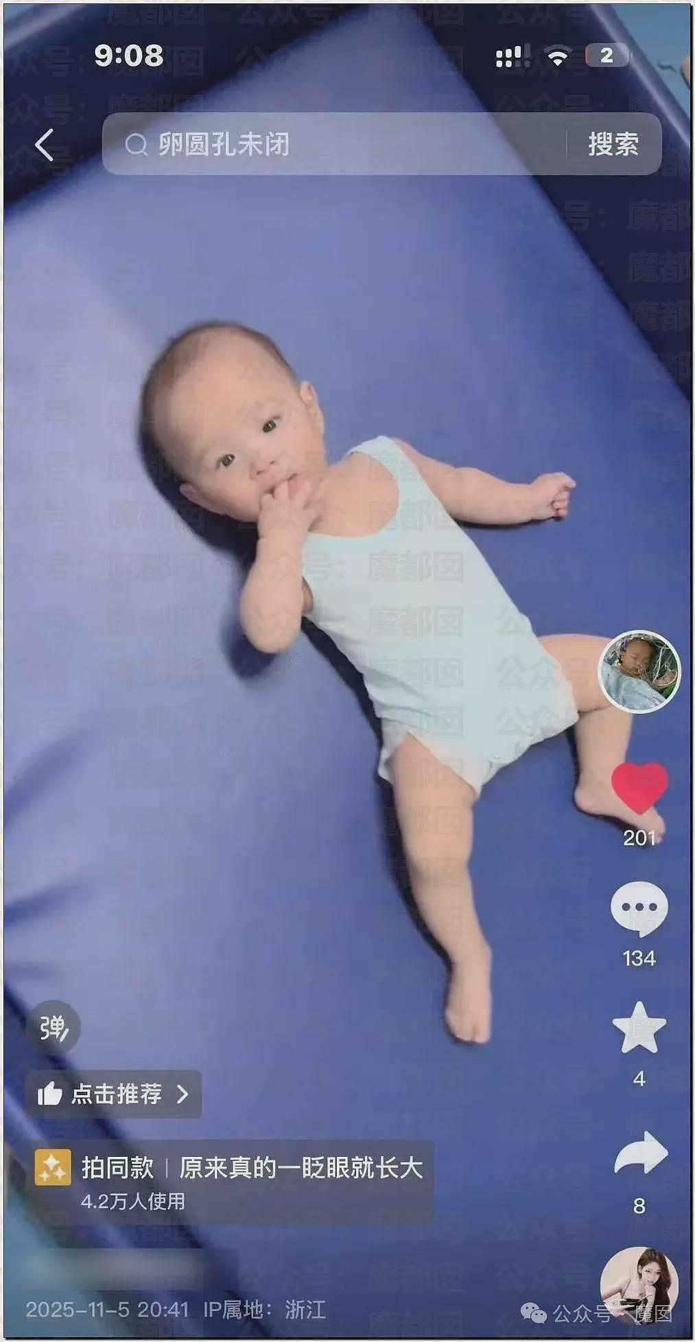 5个月婴儿做争议开胸术后去世，已有多个孩子殒命！全网为小洛熙讨说法（组图） - 13
