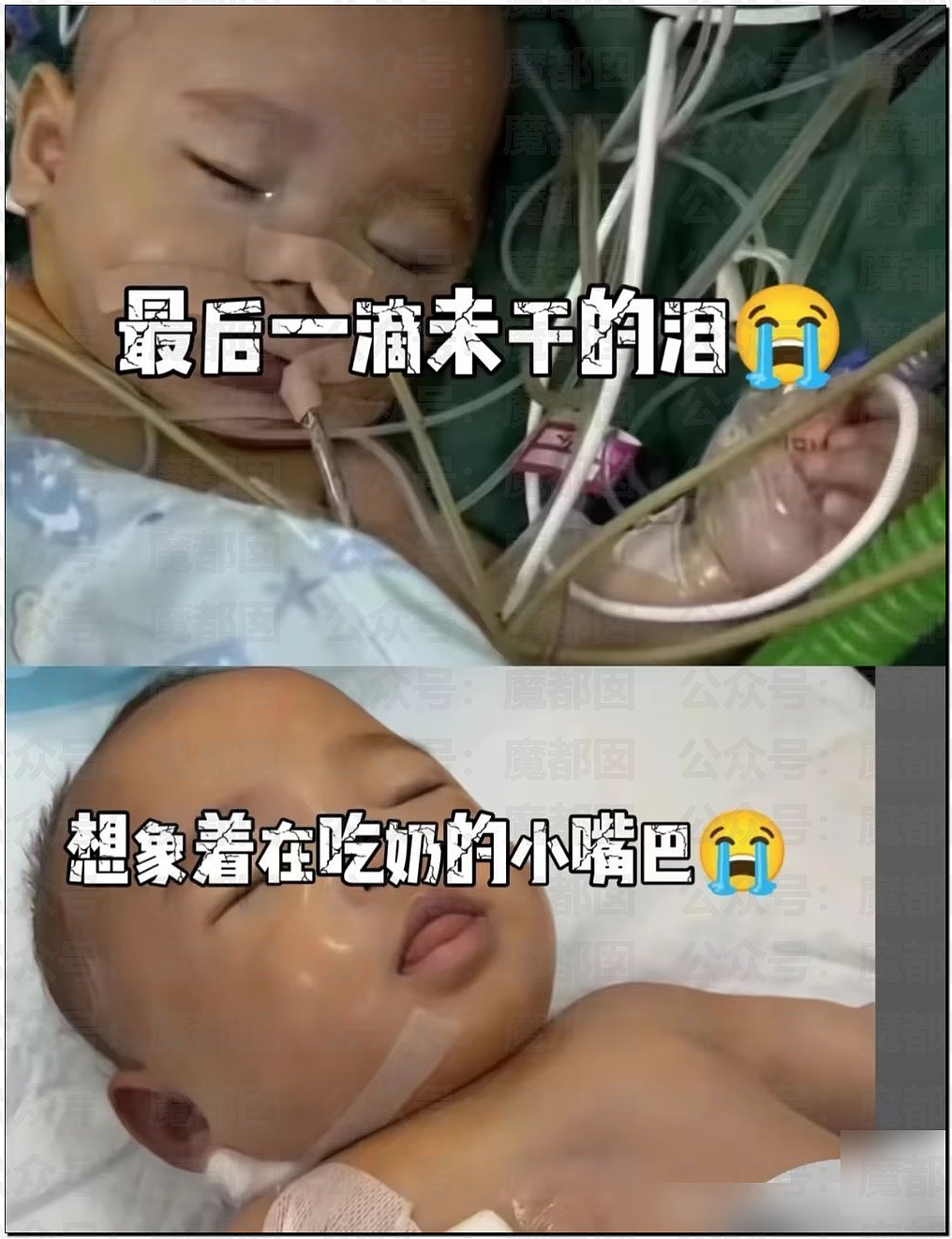 5个月婴儿做争议开胸术后去世，已有多个孩子殒命！全网为小洛熙讨说法（组图） - 46