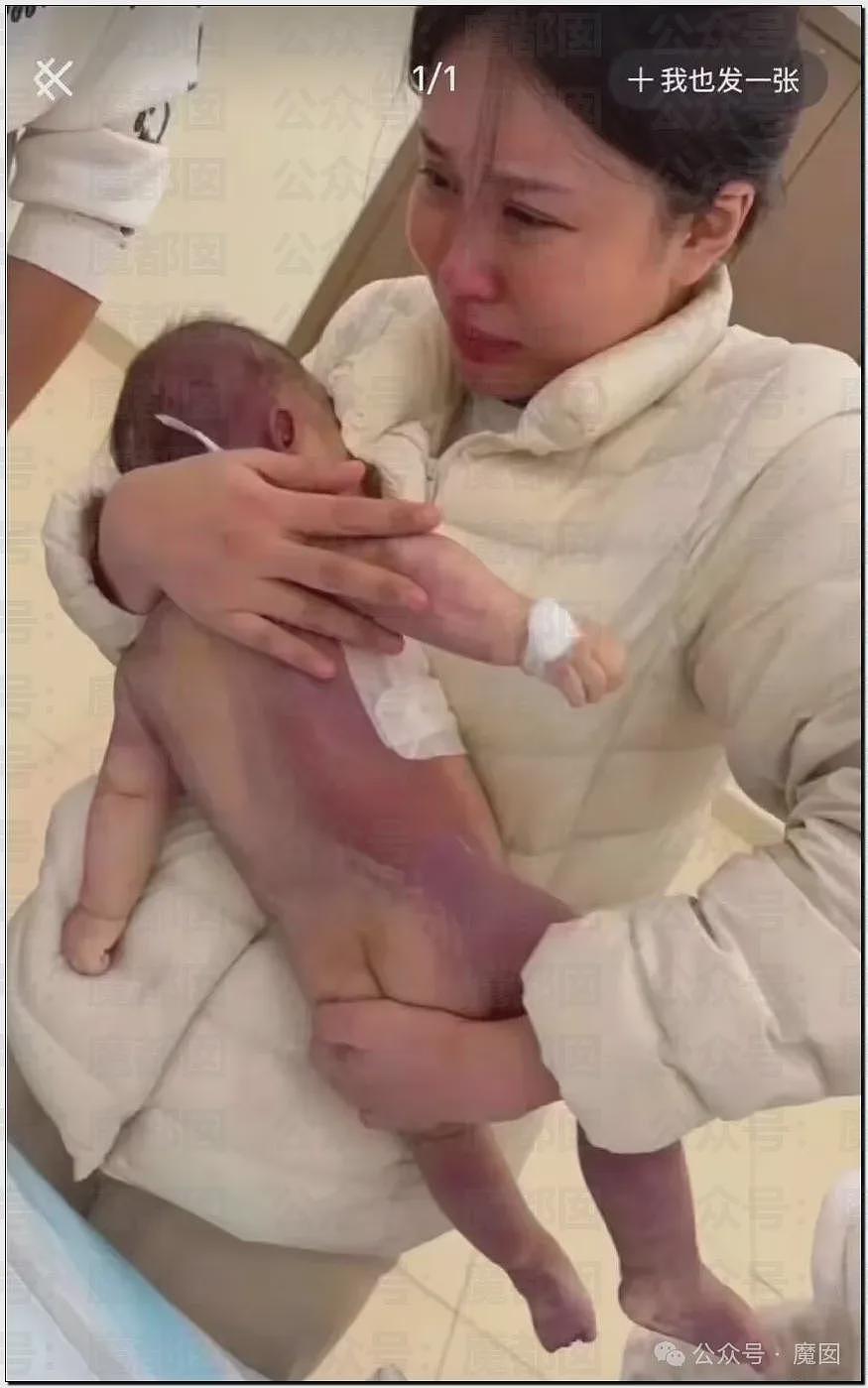 5个月婴儿做争议开胸术后去世，已有多个孩子殒命！全网为小洛熙讨说法（组图） - 5