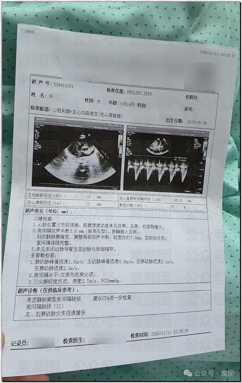 5个月婴儿做争议开胸术后去世，已有多个孩子殒命！全网为小洛熙讨说法（组图） - 3