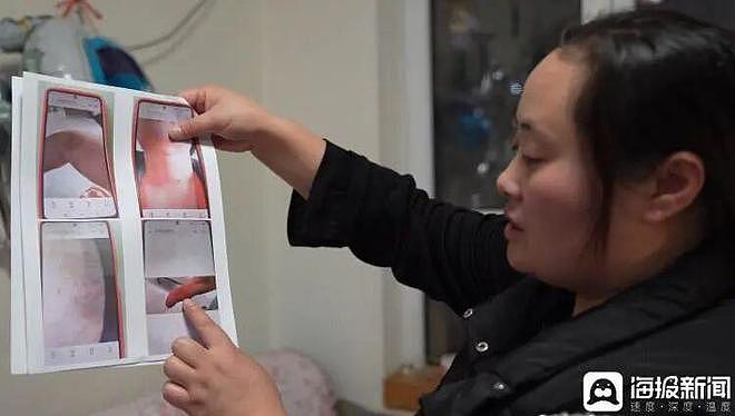 女子结婚14年遭丈夫家暴13年，致大小便失禁，孩子跪地说情被打耳光（组图） - 1