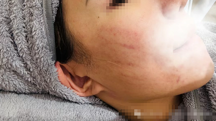 美女被体育生男友家暴才知自己是小三,自曝伤痕照评论区:这颜值当三太可惜!(组图) - 15