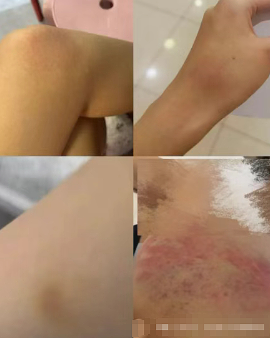 美女被体育生男友家暴才知自己是小三,自曝伤痕照评论区:这颜值当三太可惜!(组图) - 14