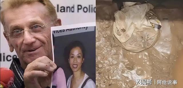 广东单亲妈妈嫁大27岁澳洲老头,6年后被盐酸溶解,只剩10颗烤瓷牙(组图) - 2