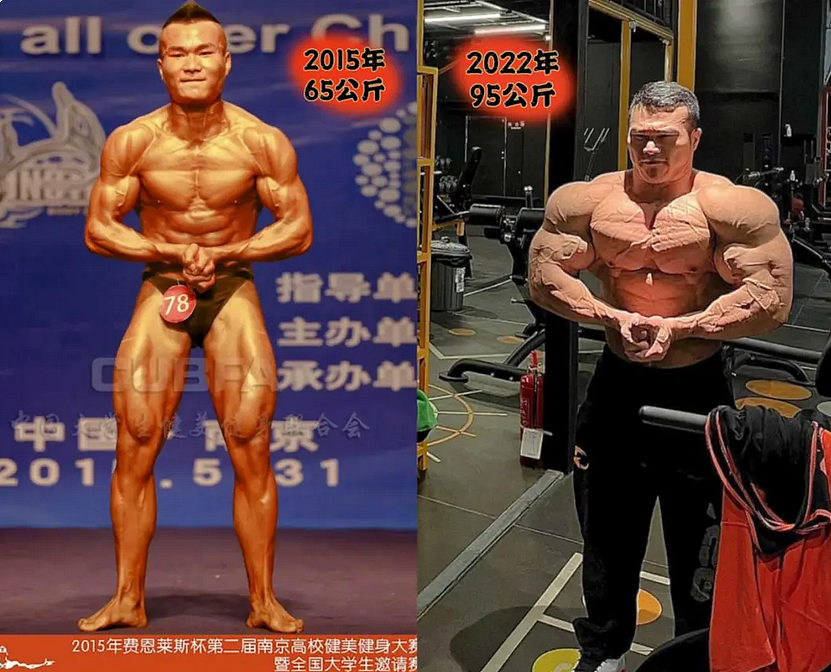 30岁健美冠军王昆死因披露!医生:这种急症,抢救成功率不足5%(组图) - 1