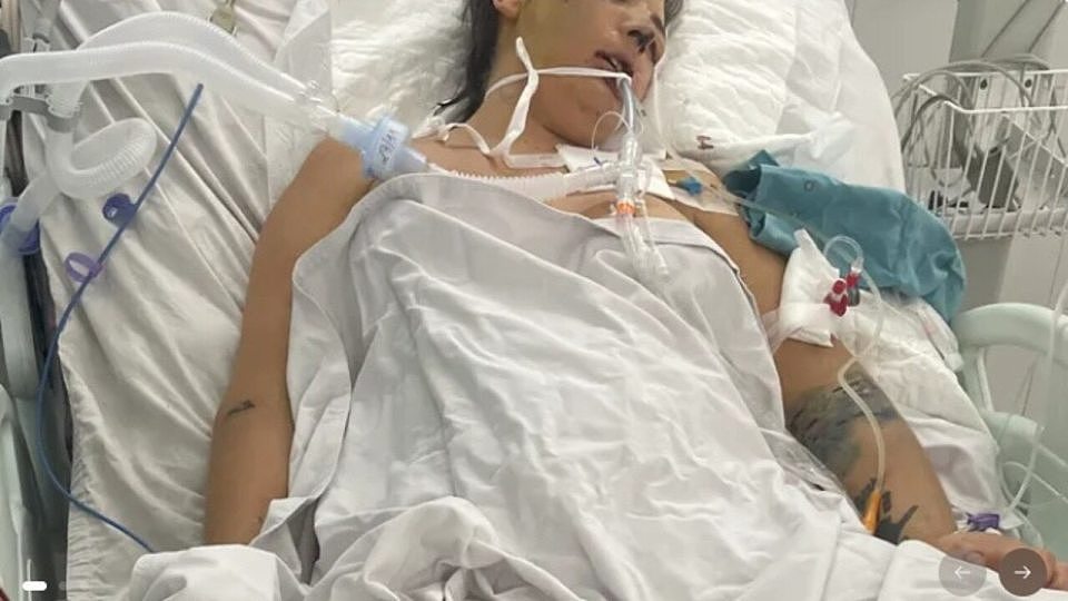 澳洲辣妈在越南接受整容手术严重失误后被困当地，现又面临面部恐怖感染（组图） - 1