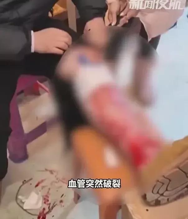 南方人游哈尔滨，-20℃血管冻裂！鲜血狂喷落地成冰（组图） - 1