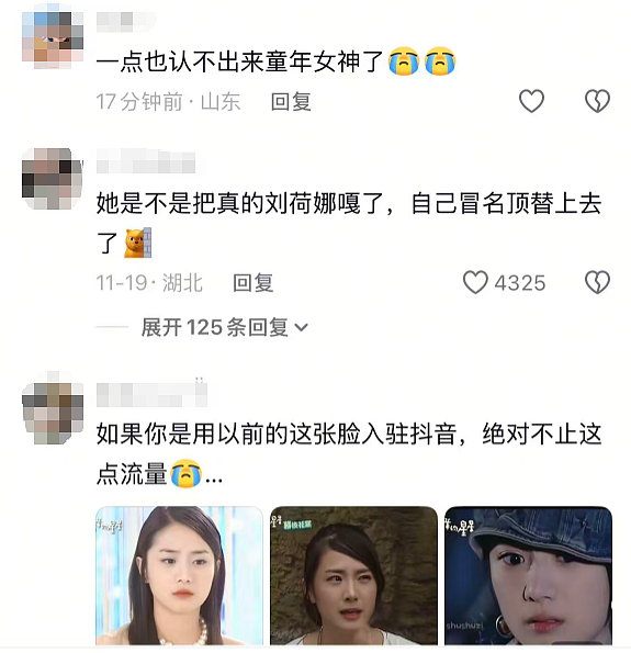 整容整毁了？！和男神虐恋，红极一时却息影，今复出换头认不出（组图） - 3