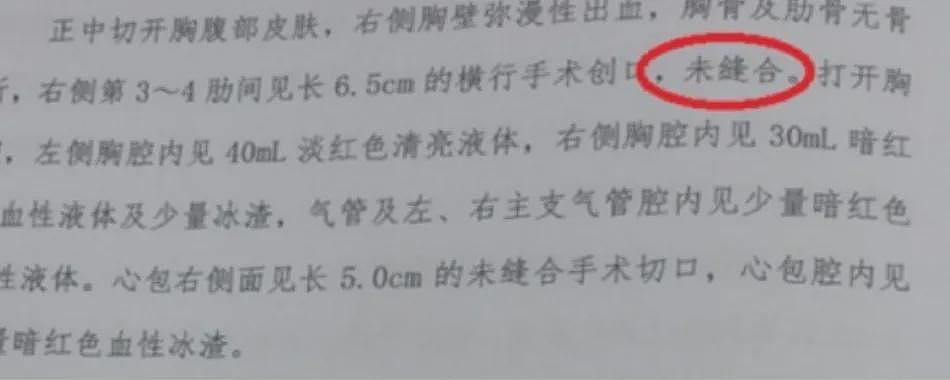 5月龄女婴手术后离世,妈妈公布法医最新尸检报告!韩红发声:错得太离谱,太让人气忿了(组图) - 2