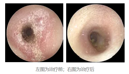 耳朵总是痒，却啥也掏不出来？可能暗示这5种问题，快自查（组图） - 8