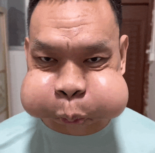 工作太不容易,男子面部严重变形!自嘲“青蛙王子”...这些都是职业病(组图) - 2