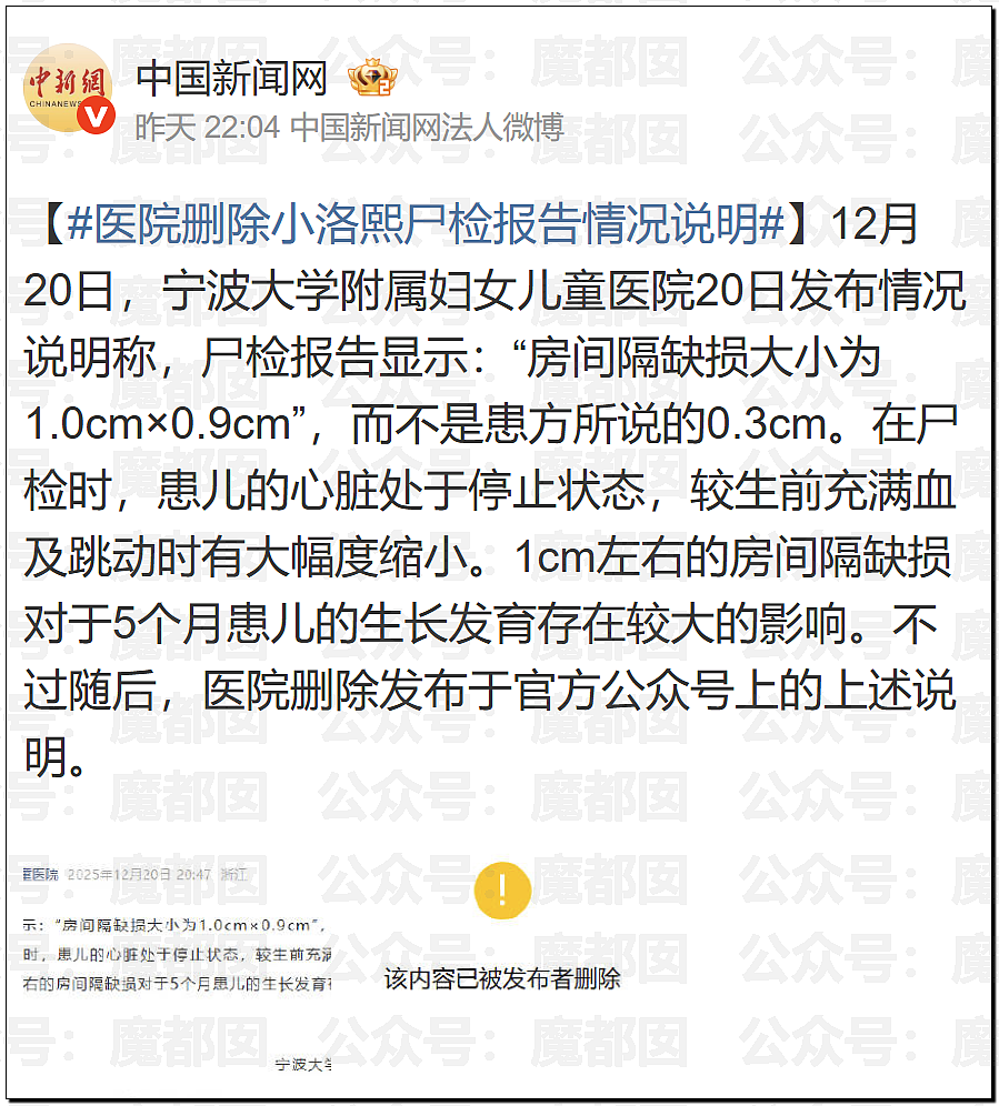 世所罕见!涉事医院发布小洛熙尸检报告说明后竟迅速删除(组图) - 15