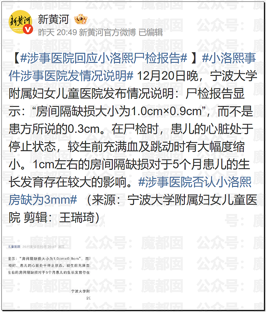 世所罕见!涉事医院发布小洛熙尸检报告说明后竟迅速删除(组图) - 3