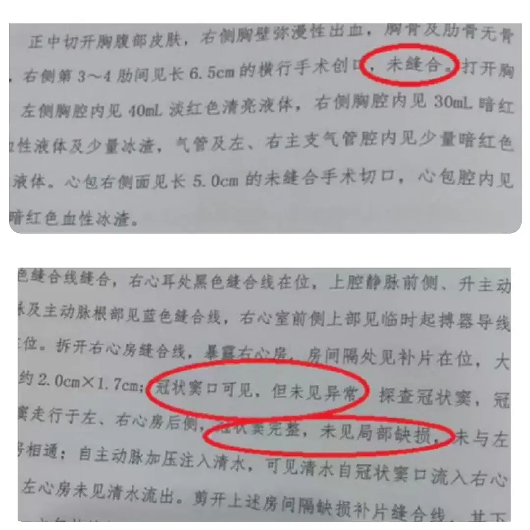 韩红直呼“太离谱”,三甲医生连番追问!5月龄小洛熙手术后离世仍需更多真相……(组图) - 3