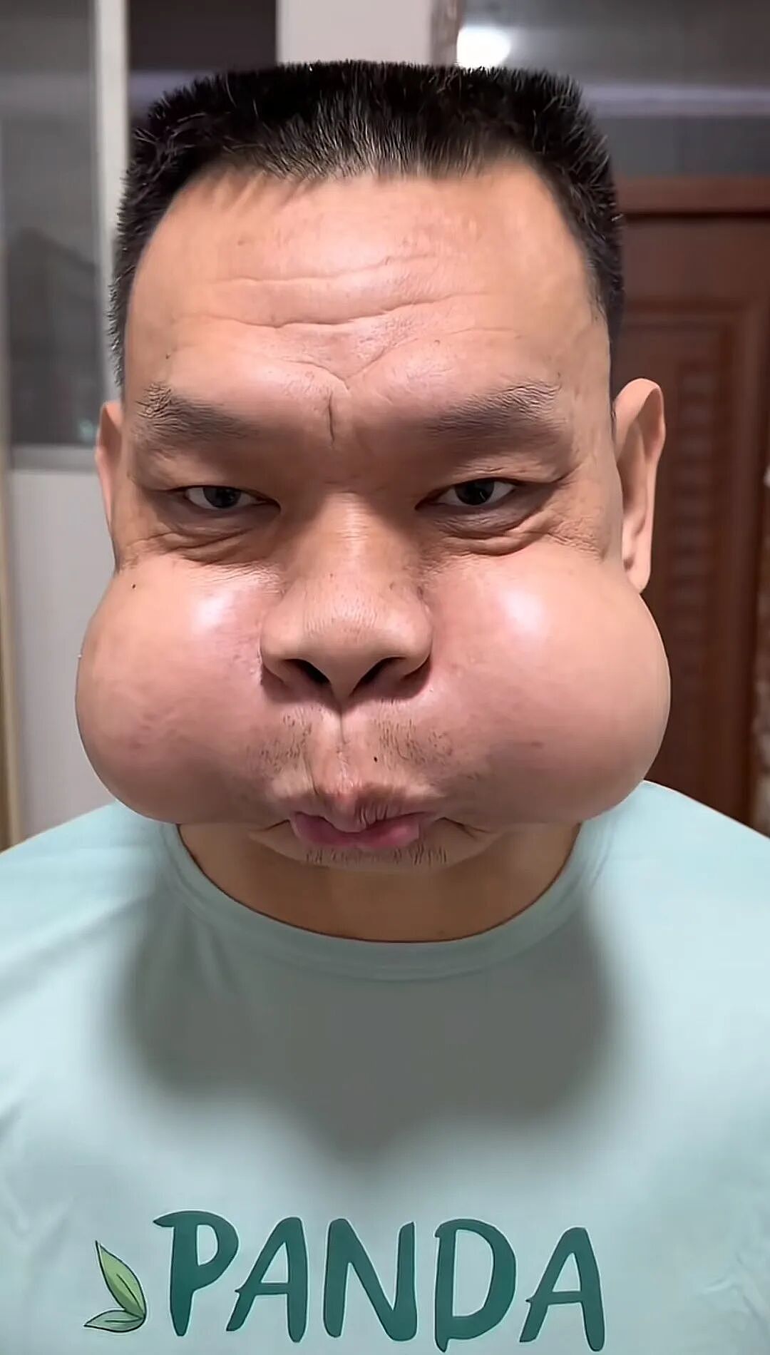 工作太不容易,男子面部严重变形!自嘲“青蛙王子”...这些都是职业病(组图) - 6