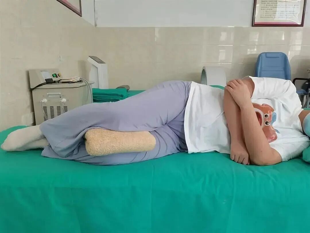 一觉醒来,21岁女生的屁股惨不忍睹!这件事不能超6小时,严重或危及生命(组图) - 5