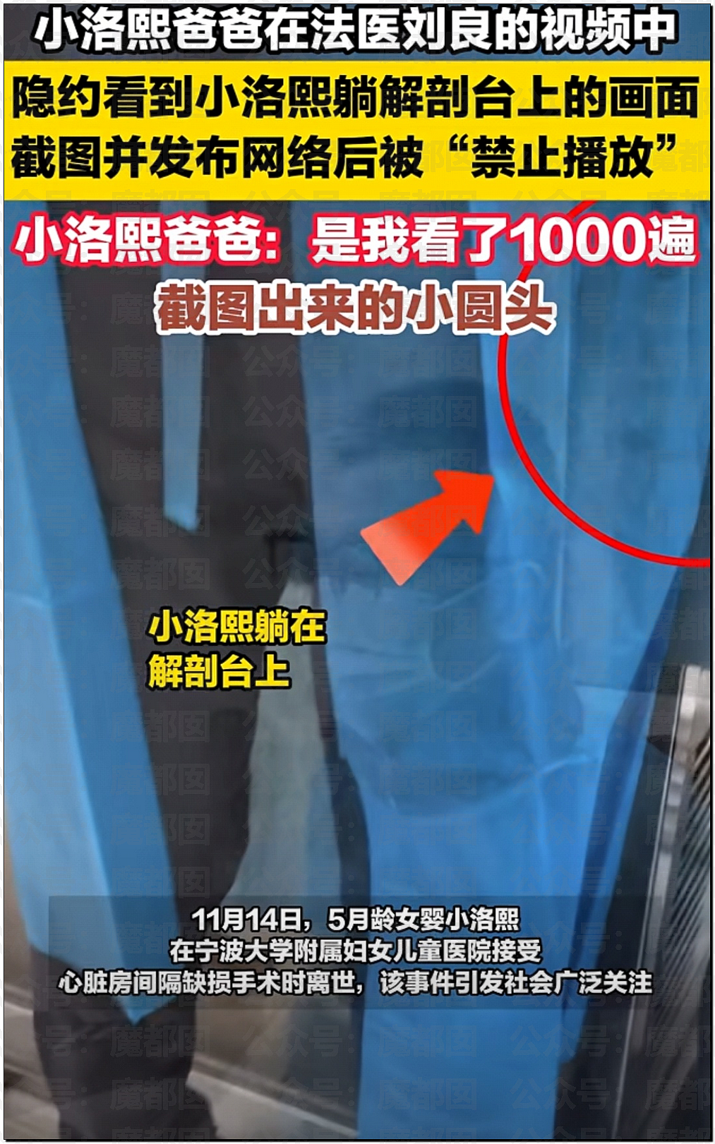 哭死！小洛熙爸爸发现尸检台上小圆头，父母生育隐私竟遭泄露（组图） - 10