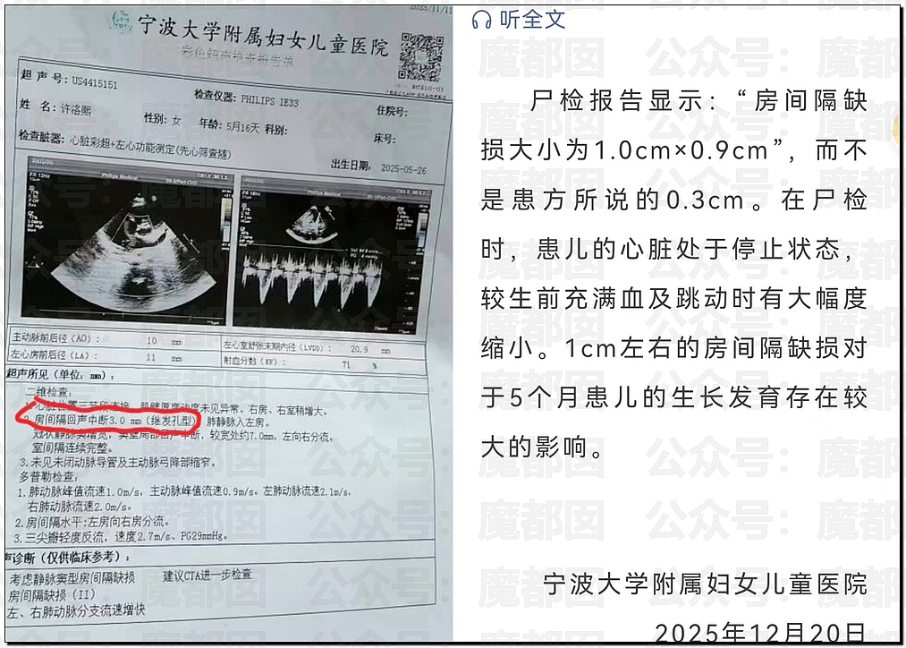 哭死！小洛熙爸爸发现尸检台上小圆头，父母生育隐私竟遭泄露（组图） - 1