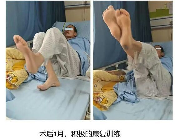 大陆老翁“头颈分离”,医生用妙招救回:能活著到医院就是奇迹(组图) - 2