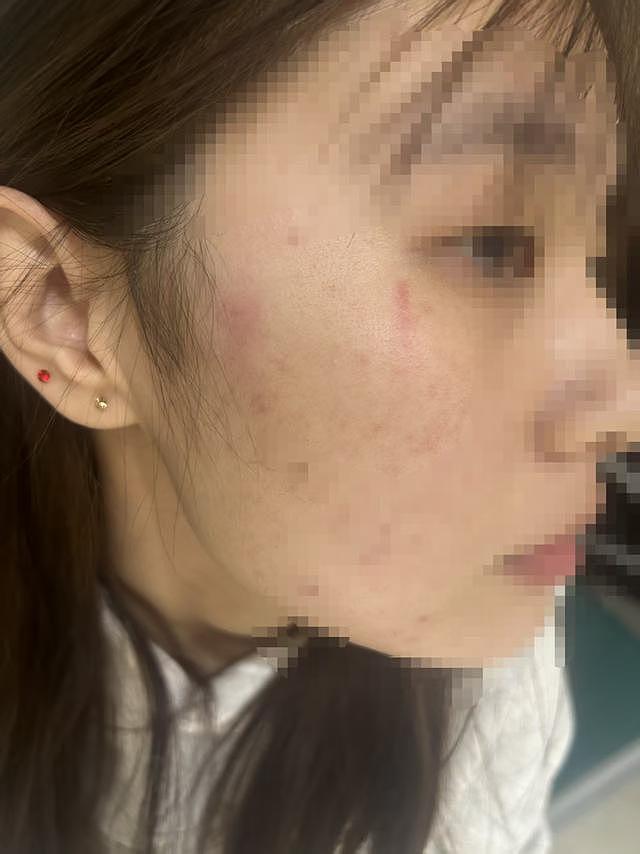 陌生人上门讨说法，18岁女孩独自在家起冲突被认定互殴（组图） - 2