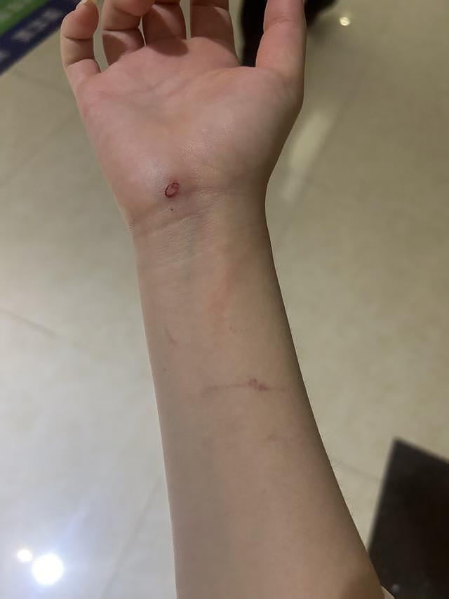 陌生人上门讨说法，18岁女孩独自在家起冲突被认定互殴（组图） - 1